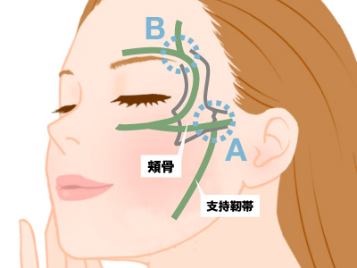 港区でヒアルロン酸注入を受けるなら美容外科・美容皮膚科 青い鳥