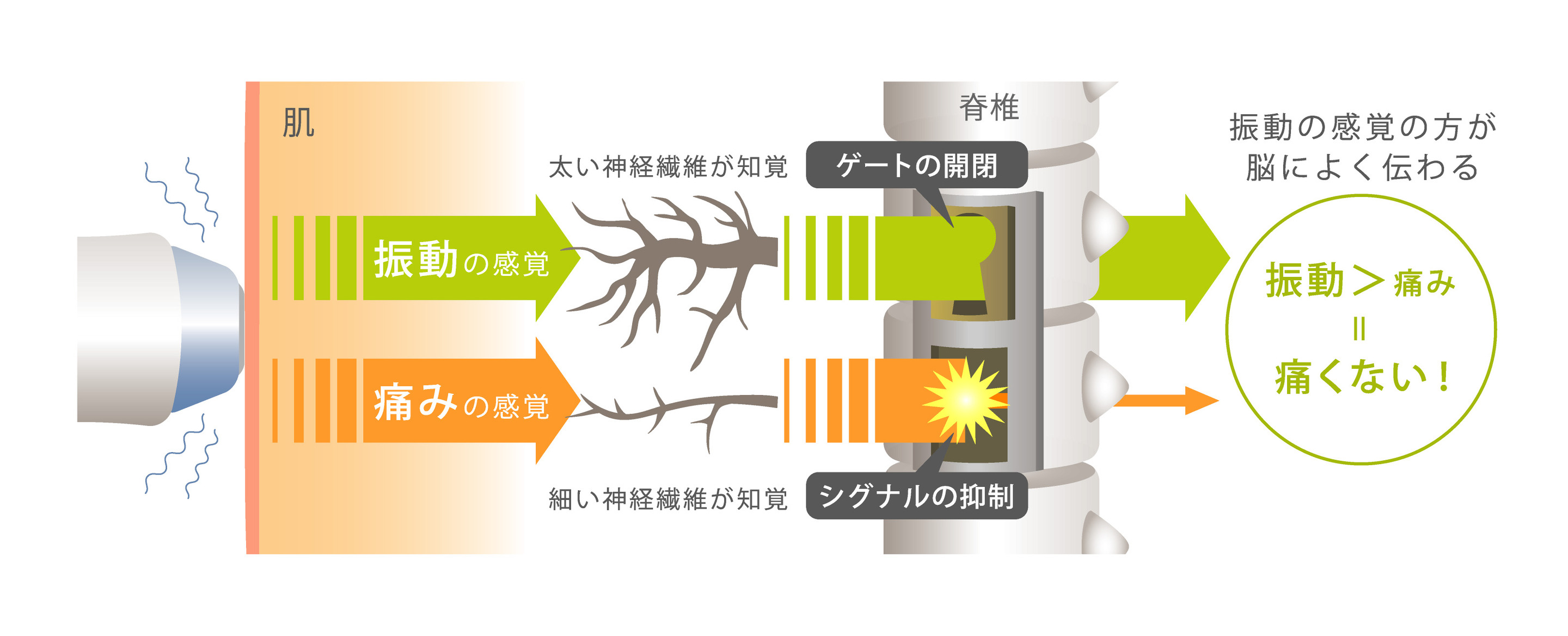 痛みに対してのテクノロジー:港区でサーマクールを受けるなら美容外科・美容皮膚科 青い鳥