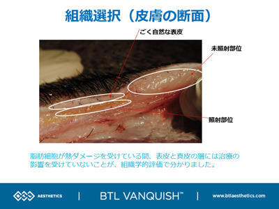 治療部位の断面