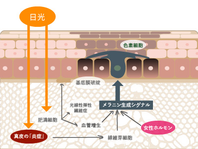 肝斑における色素増強メカニズム