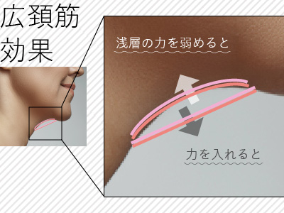広頚筋効果