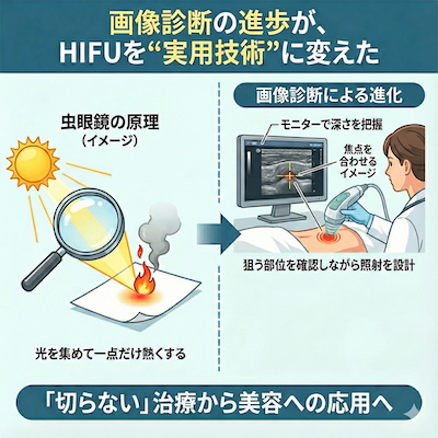 ハイフの美容への応用