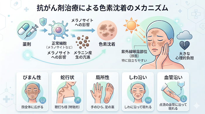 抗がん剤による色素沈着