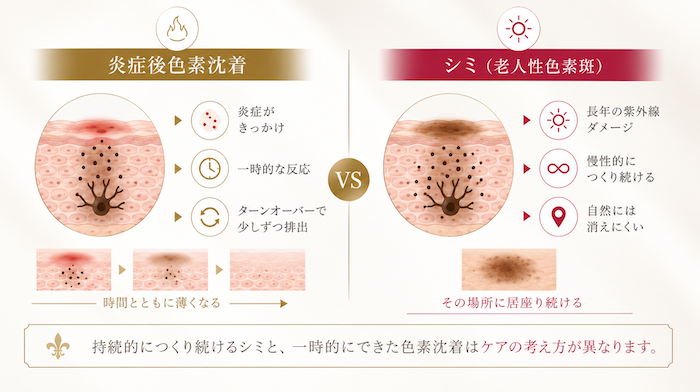 シミと色素沈着の違い