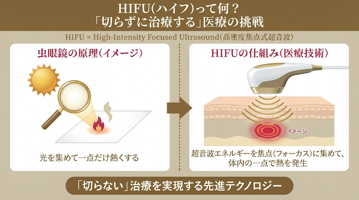 ハイフの根本原理