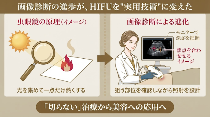 画像診断の進歩がハイフを実用技術に変えた