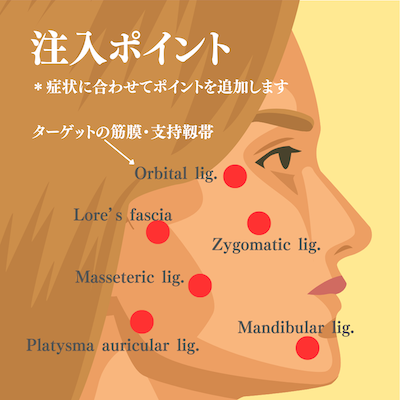 ジャルプロ・スーパーハイドロ:港区でジャルプロスーパーハイドロを受けるなら美容外科・美容皮膚科 青い鳥