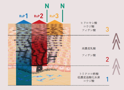 リバースピーリング